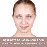 TÓNICO LB - DESPIGMANTANTE PRO